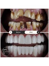 DentaPoint | Dental Hospital