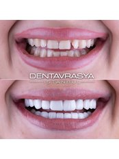 Dentavrasya Dental Clinic Istanbul